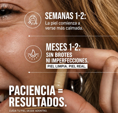 CLEARADVANCE™ - Combate el acné hormonal